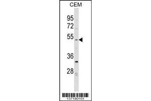 EVI2B Antibody (Center)  western blot analysis in CEM cell line lysates (35ug/lane).