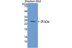 Image no. 1 for anti-Complement Component 1, Q Subcomponent Binding Protein (C1QBP) (AA 72-279) antibody (ABIN1078151)