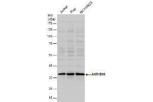 Image no. 3 for anti-Aldo-Keto Reductase Family 1, Member B10 (Aldose Reductase) (AKR1B10) (full length) antibody (ABIN2856687)