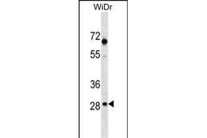 SNX11 Antibody (Center) (ABIN1538607 and ABIN2850241) western blot analysis in WiDr cell line lysates (35 μg/lane).