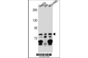 Image no. 1 for anti-Zinc Finger Protein 555 (ZNF555) (AA 592-620), (C-Term) antibody (ABIN657163)