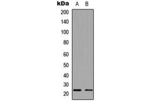 Image no. 2 for anti-NADH Dehydrogenase (Ubiquinone) 1 beta Subcomplex, 9, 22kDa (NDUFB9) (Center) antibody (ABIN2706662)
