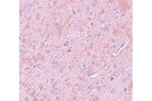 Image no. 3 for anti-Protein Inhibitor of Activated STAT, 2 (PIAS2) (N-Term) antibody (ABIN6656301)