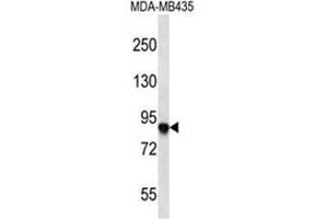 Image no. 1 for anti-Actin Filament Associated Protein 1 (AFAP1) (AA 550-580), (C-Term) antibody (ABIN950292)