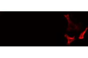 Image no. 2 for anti-Cdk5 and Abl Enzyme Substrate 1 (CABLES1) (C-Term) antibody (ABIN6262503)