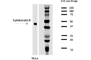 Image no. 2 for anti-Keratin 8 (KRT8) antibody (ABIN94300)