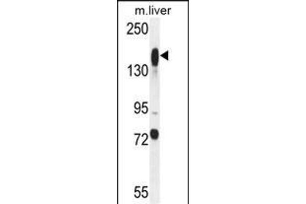 ASXL1 antibody  (AA 521-549)