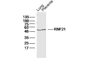 Image no. 1 for anti-RNF21 (Rnf227) antibody (ABIN1385377)