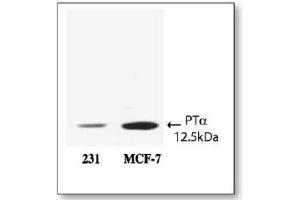 Image no. 1 for anti-Prothymosin, alpha (PTMA) (AA 75-109) antibody (ABIN191612)