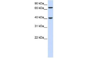 Image no. 1 for anti-PDZ and LIM Domain 3 (PDLIM3) (N-Term) antibody (ABIN631568)