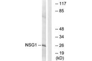 Image no. 1 for anti-Neuron-Specific Protein Family Member 1 (D4S234E) (AA 112-161) antibody (ABIN1535104)