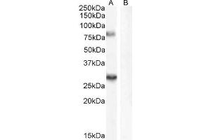 Image no. 3 for anti-Synaptic Vesicle Glycoprotein 2A (SV2A) (Internal Region) antibody (ABIN185715)
