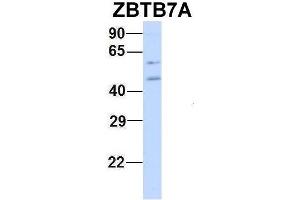 Image no. 4 for anti-Zinc Finger and BTB Domain Containing 7A (ZBTB7A) (N-Term) antibody (ABIN2780246)