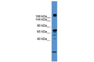 Image no. 1 for anti-Rearranged L-Myc Fusion (RLF) (N-Term) antibody (ABIN2780882)