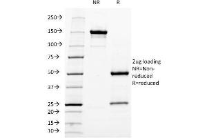 Image no. 1 for anti-Neurofilament, Heavy Polypeptide (NEFH) antibody (ABIN6940180)