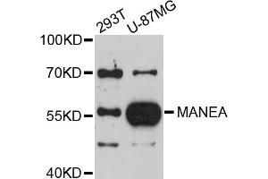 Image no. 1 for anti-Mannosidase, Endo-alpha (MANEA) antibody (ABIN4904288)