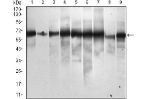 Image no. 3 for anti-Sequestosome 1 (SQSTM1) (AA 232-356) antibody (ABIN1846090)