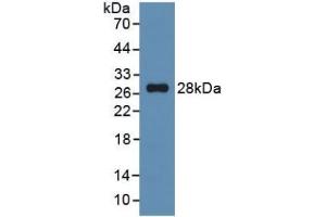 Image no. 4 for C-Reactive Protein (CRP) ELISA Kit (ABIN6574108)