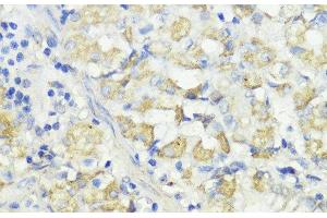 Immunohistochemistry of paraffin-embedded Human stomach using CTSB Polyclonal Antibody at dilution of 1:100 (40x lens).