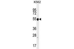 Image no. 1 for anti-Keratin 25 (KRT25) (AA 387-426), (C-Term) antibody (ABIN951813)