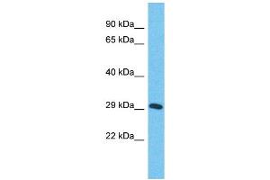 Image no. 1 for anti-Zinc Finger Protein 625 (ZNF625) (Middle Region) antibody (ABIN2784274)
