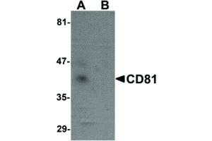 Image no. 1 for anti-CD81 (CD81) (N-Term) antibody (ABIN6657057)