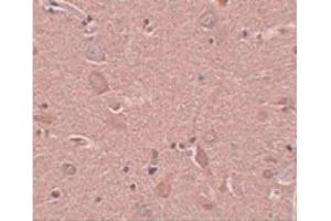 Image no. 3 for anti-Sushi-Repeat Containing Protein, X-Linked (SRPX) (N-Term) antibody (ABIN6657255)