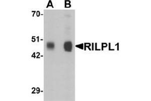 Image no. 2 for anti-Rab Interacting Lysosomal Protein-Like 1 (RILPL1) (N-Term) antibody (ABIN1450059)