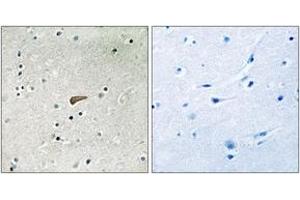 Image no. 2 for anti-Fibroblast Growth Factor Receptor Substrate 2 (FRS2) (AA 402-451), (pTyr436) antibody (ABIN1532103)