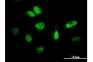 Immunofluorescence of purified MaxPab antibody to CDKN3 on HeLa cell.
