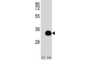 Image no. 1 for anti-Sirtuin 5 (SIRT5) (AA 99-127) antibody (ABIN3032594)