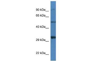Image no. 1 for anti-Sarcoglycan, delta (35kDa Dystrophin-Associated Glycoprotein) (SGCD) (N-Term) antibody (ABIN2781786)