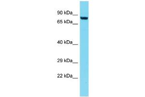 Host: Rabbit Target Name: DPY19L3 Sample Type: Jurkat Whole Cell lysates Antibody Dilution: 1.