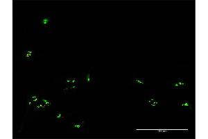 Immunofluorescence of purified MaxPab antibody to RBM19 on HeLa cell.