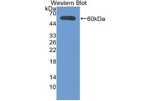 Image no. 1 for anti-Deiodinase, Iodothyronine, Type II (DIO2) (AA 30-259) antibody (ABIN1858636)