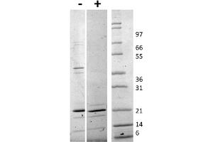 Image no. 2 for Tumor Necrosis Factor (Ligand) Superfamily, Member 10 (TNFSF10) protein (ABIN6700756)