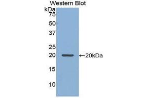 Image no. 1 for anti-Nucleoporin 210kDa (NUP210) (AA 1149-1295) antibody (ABIN1860082)