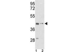 anti-Actin, gamma 1 (ACTG1) (AA 188-215) antibody
