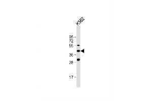 Image no. 4 for anti-Vascular Endothelial Growth Factor C (VEGFC) (AA 20-49), (N-Term) antibody (ABIN655891)