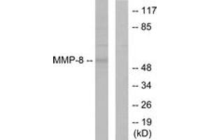 Image no. 2 for anti-Matrix Metallopeptidase 8 (Neutrophil Collagenase) (MMP8) (AA 418-467) antibody (ABIN1533354)