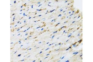 Immunohistochemistry of paraffin-embedded Rat heart using RAF1 Polyclonal Antibody at dilution of 1:100 (40x lens).