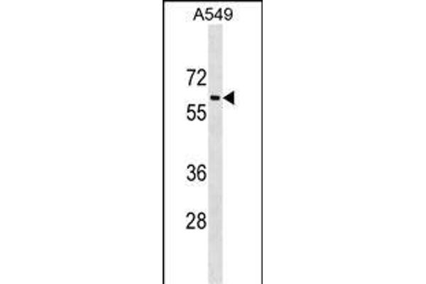 TRAM1L1 抗体  (C-Term)