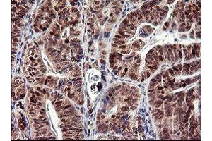 Image no. 2 for anti-Tumor Protein P73 (TP73) (AA 167-409) antibody (ABIN1491006)
