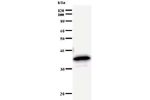 Image no. 2 for anti-Bromodomain Containing 3 (BRD3) antibody (ABIN933105)