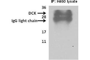 Image no. 1 for anti-Deoxycytidine Kinase (DCK) (AA 171-200), (C-Term) antibody (ABIN391125)