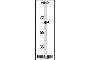 Image no. 1 for anti-Dual-Specificity tyrosine-(Y)-phosphorylation Regulated Kinase 2 (DYRK2) (AA 105-135) antibody (ABIN1539912)