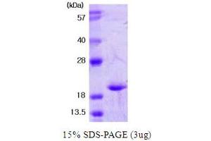 Superoxide Dismutase 1, Soluble (SOD1) (AA 1-154) protein