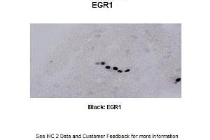 Image no. 2 for anti-Early Growth Response 1 (EGR1) (C-Term) antibody (ABIN2779827)