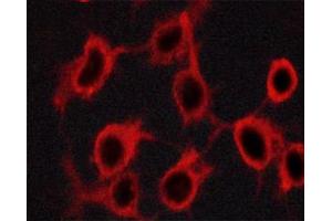 Image no. 4 for anti-Tyrosine Hydroxylase (TH) (pSer19) antibody (ABIN6255056)