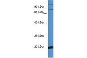 Image no. 1 for anti-Nuclear Factor of kappa Light Polypeptide Gene Enhancer in B-Cells Inhibitor, zeta (NFKBIZ) (C-Term) antibody (ABIN6746523)